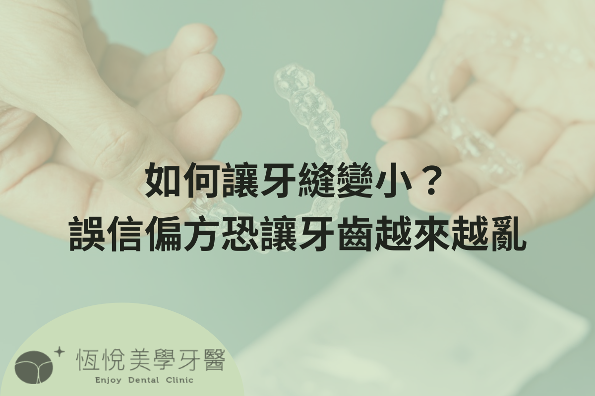 Read more about the article 如何讓牙縫變小？誤信偏方恐讓牙齒越來越亂