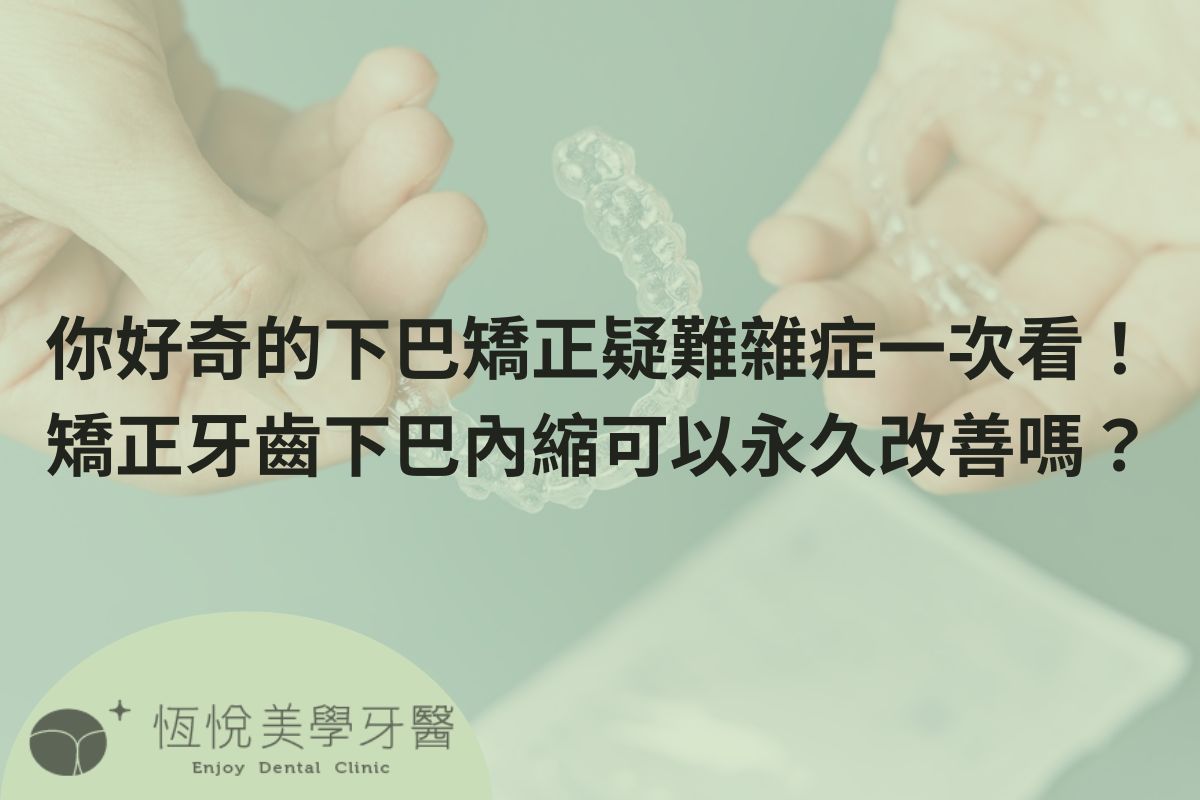 Read more about the article 你好奇的下巴矯正疑難雜症一次看！矯正牙齒下巴內縮可以永久改善嗎？