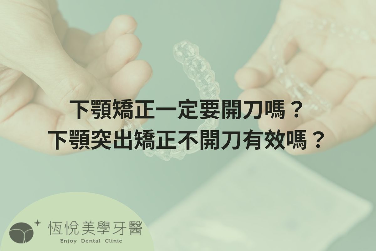 Read more about the article 下顎矯正一定要開刀嗎？下顎突出矯正不開刀有效嗎？