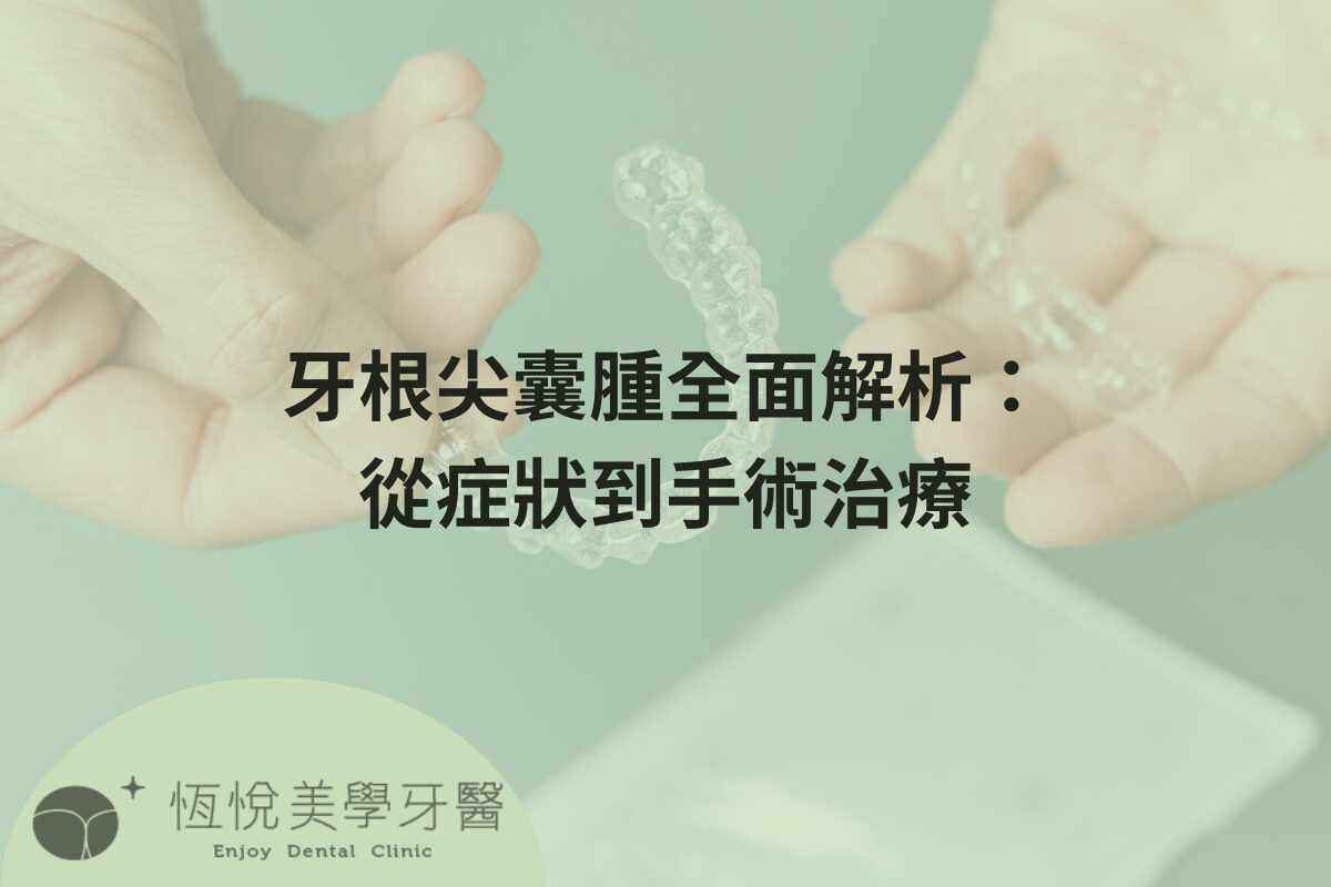 Read more about the article 牙根尖囊腫全面解析：從症狀到手術治療