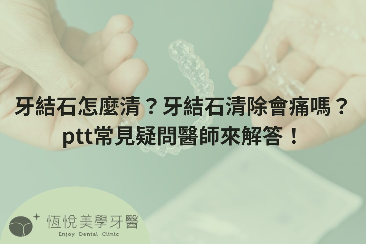 Read more about the article 牙結石怎麼清？牙結石清除會痛嗎？ptt常見疑問醫師來解答！