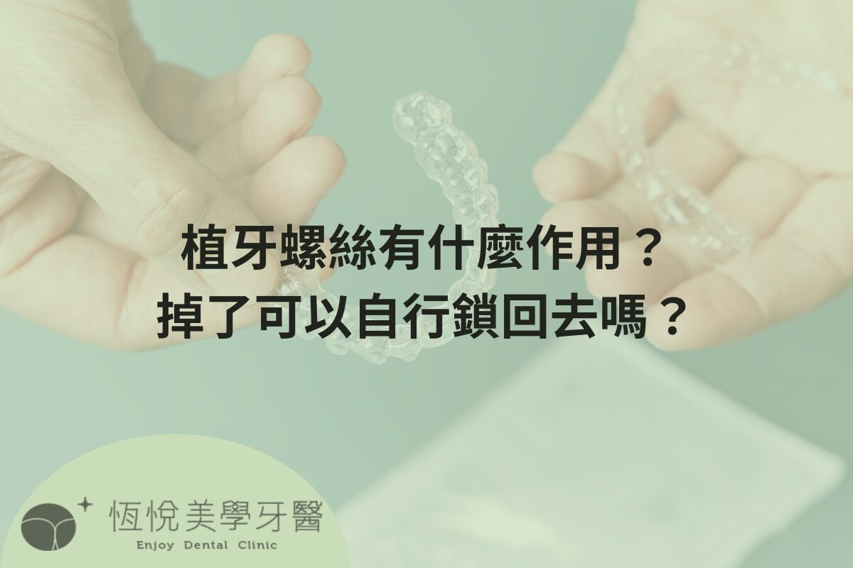 Read more about the article 植牙螺絲有什麼作用？掉了可以自行鎖回去嗎？