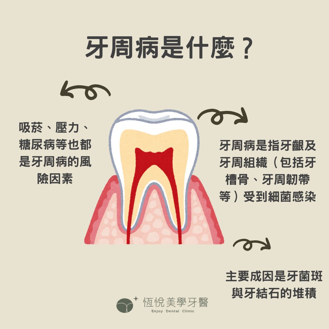 牙周病原理