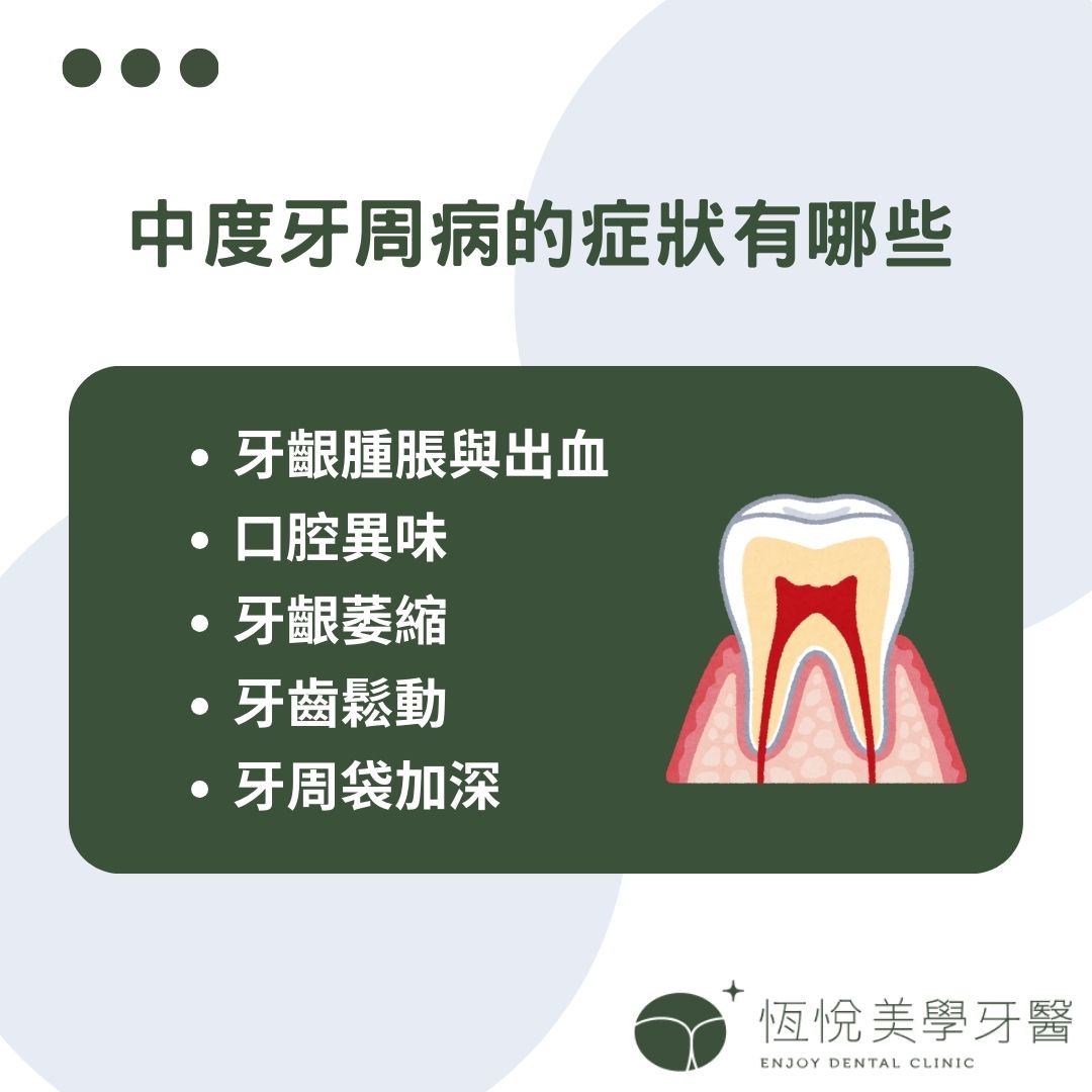 說明中度牙周病的症狀有哪些