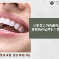 牙齦發炎消炎藥有用嗎？牙醫教你如何對付牙齦發炎