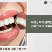 中度牙周病還有救嗎？治療方法與改善秘訣！