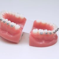 teeth-2022-11-15-23-14-12-utc (2)