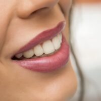 teeth-and-lips-2022-04-19-01-56-23-utc (1)