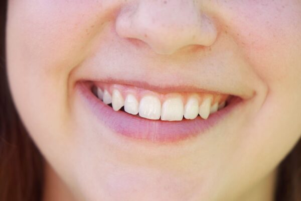 young-woman-with-toothy-smile-and-perfect-white-te-2022-11-16-17-06-37-utc (2)