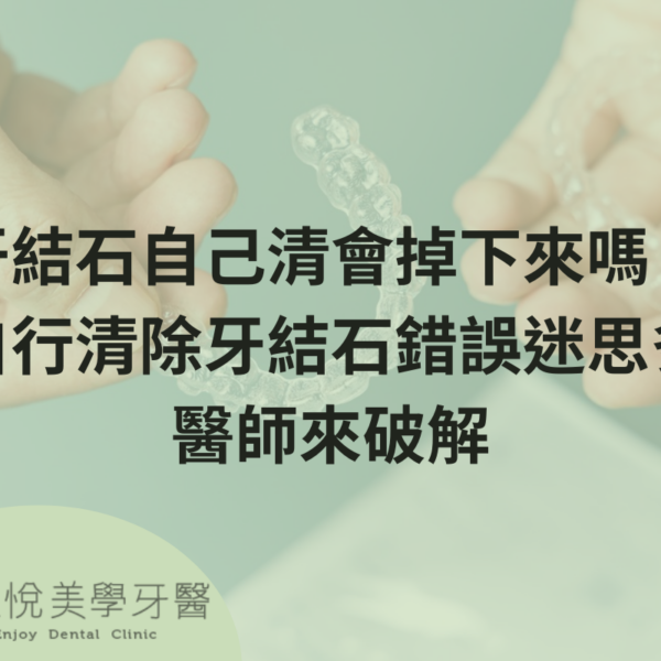 補骨粉不能省，醫：忽略補骨恐釀植牙失敗 (1)