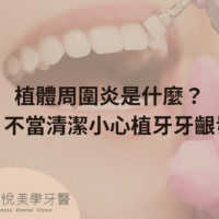 植體周圍炎是什麼？醫：不當清潔小心植牙牙齦發炎